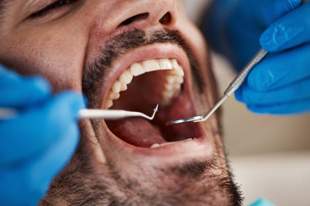 Best Emergency Dentist for Knocked-Out Tooth in Manning, IA